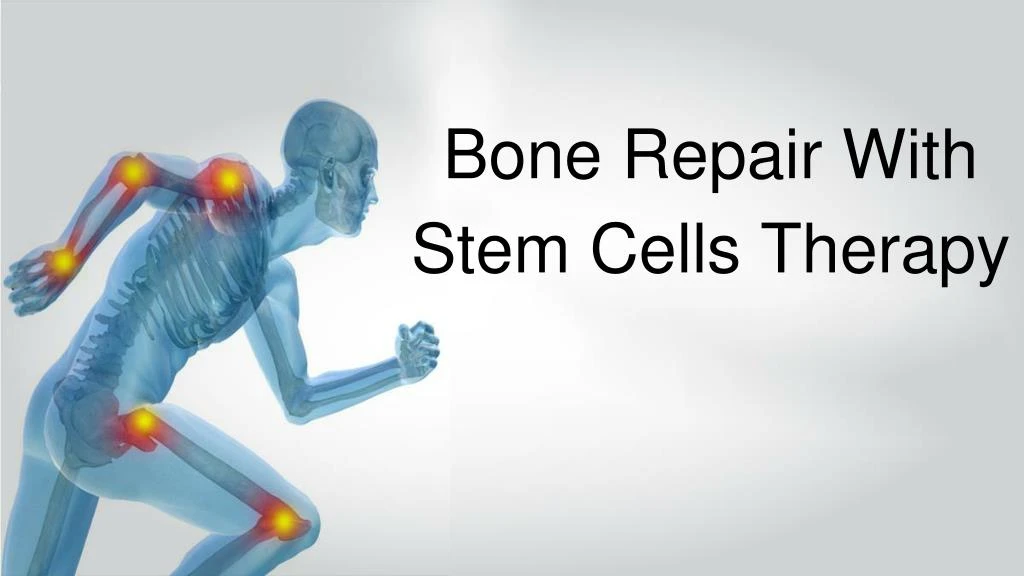 bone repair with stem cells therapy