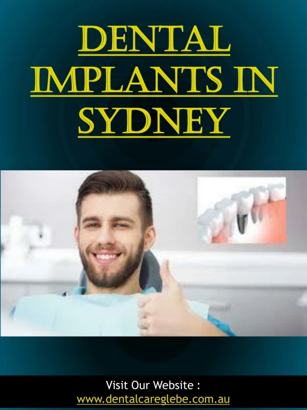 Dental Implants In Sydney