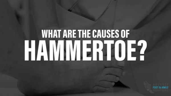 What are the Causes of Hammertoe?