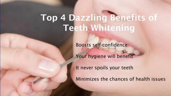Top 4 Dazzling Benefits of Teeth Whitening