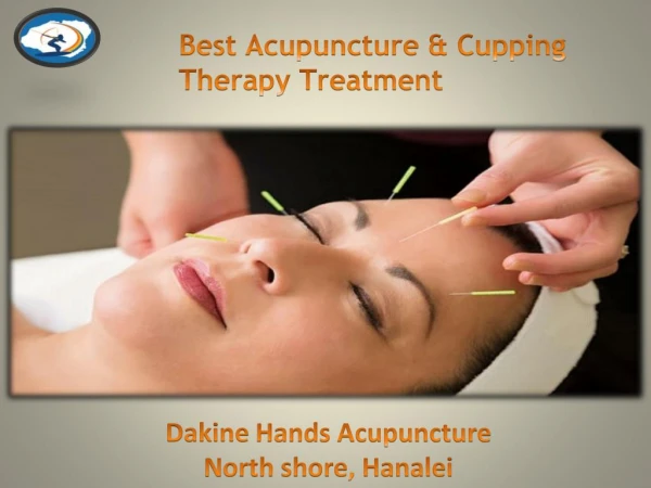Find Best Cupping Therapy and Acupuncture in North Shore, Hanalei