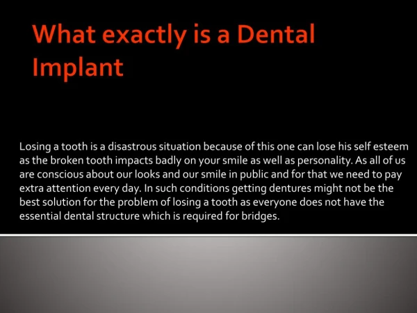 What exactly is a Dental Implant