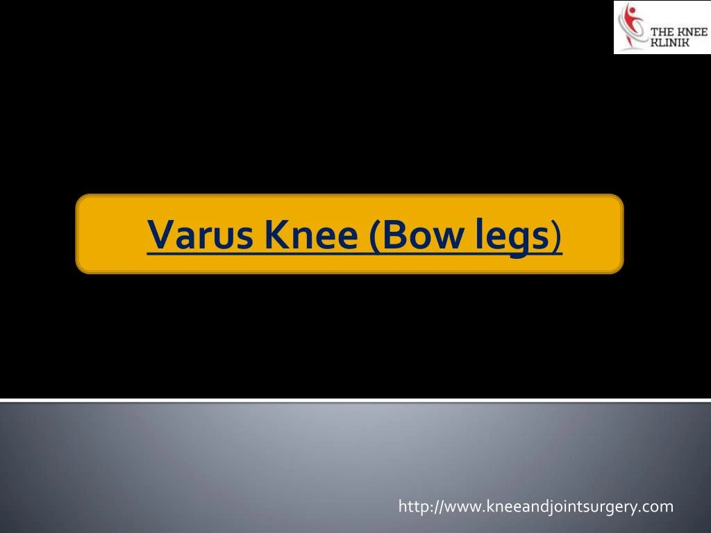 varus knee bow legs