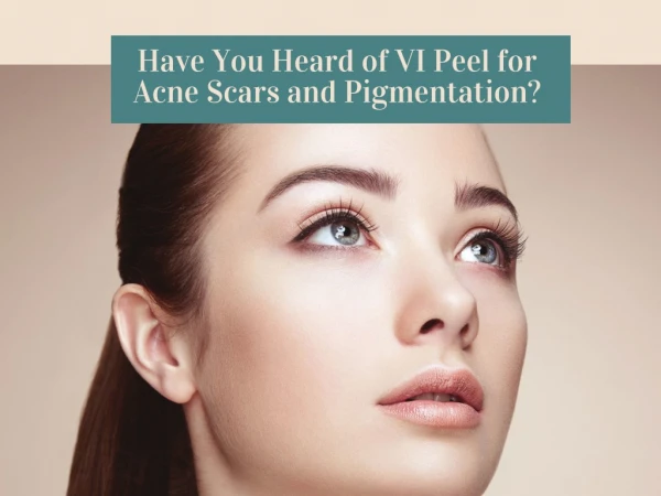 Have You Heard of VI Peel for Acne Scars and Pigmentation?