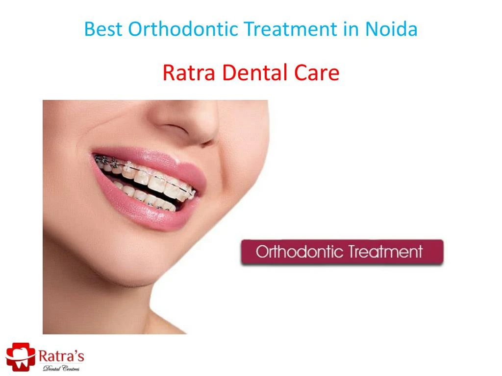 best orthodontic treatment in noida