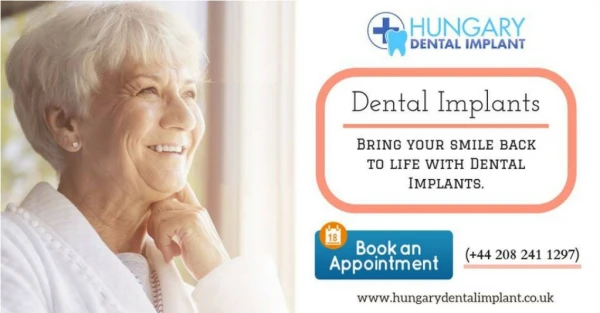 Bring Your Smile Back to Life with Dental Implants in London