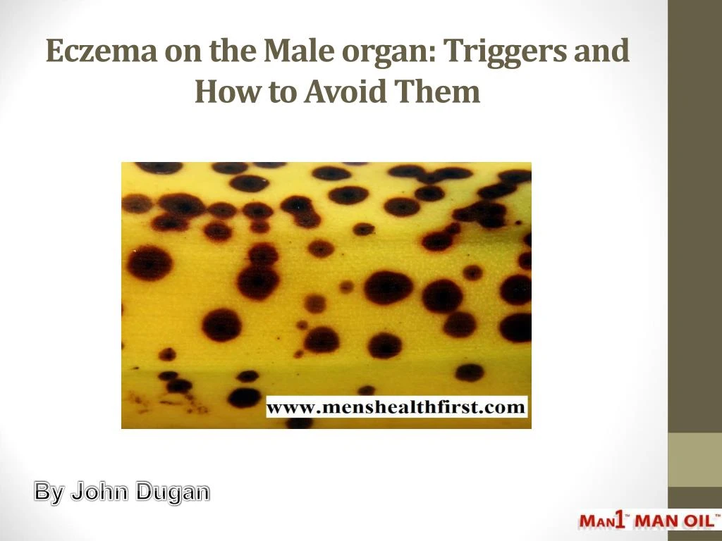 Ppt Eczema On The Male Organ Triggers And How To Avoid Them Powerpoint Presentation Id8089980