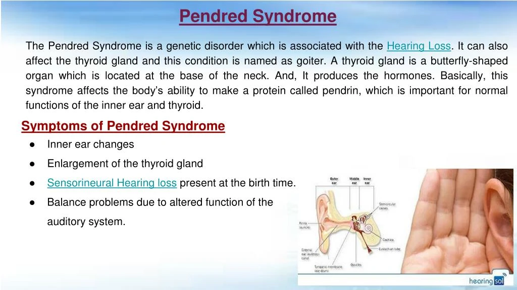 pendred syndrome