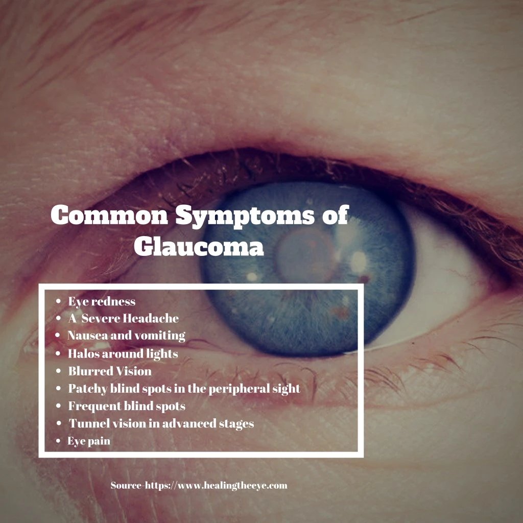 common symptoms of glaucoma
