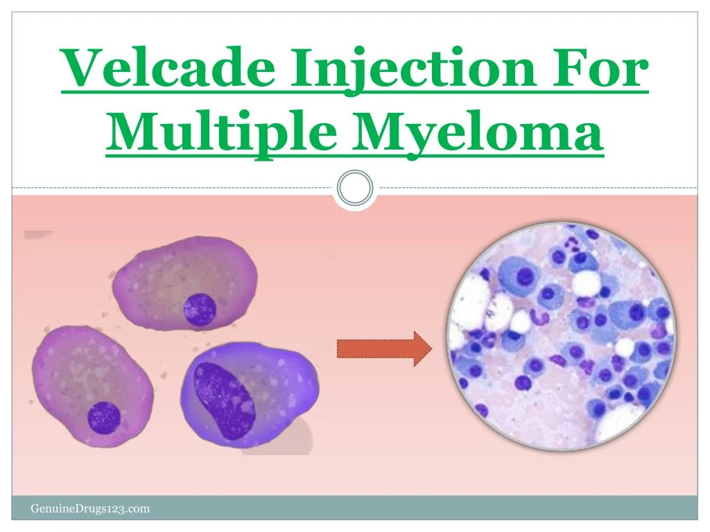 velcade injection for multiple myeloma