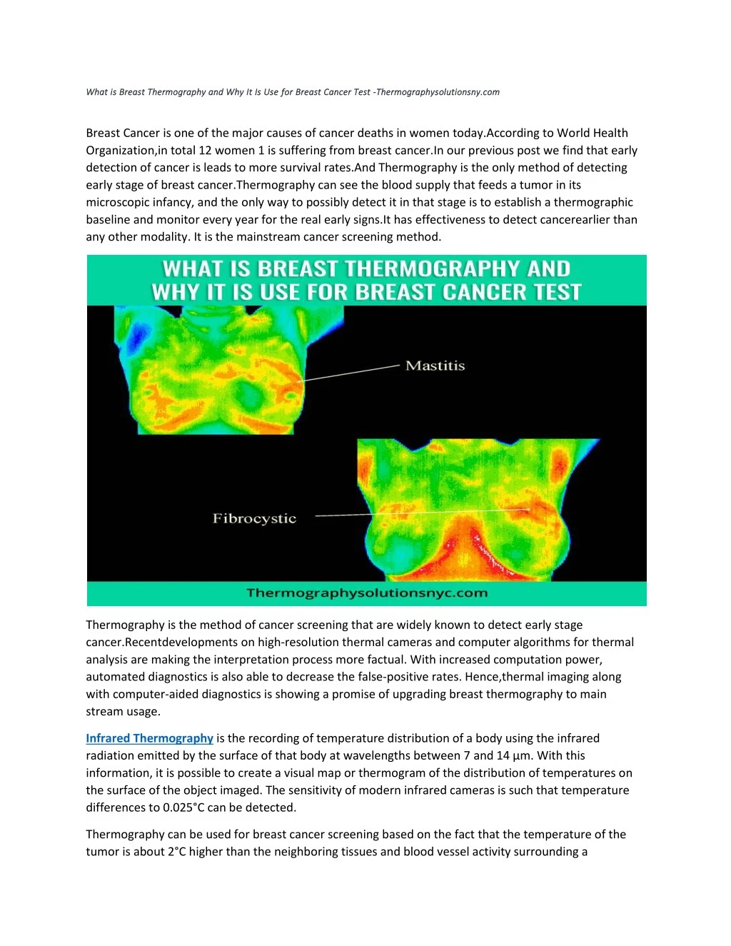 what is breast thermography