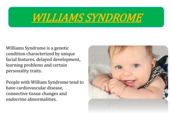Best Treatment for Williams Syndrome in Bangalore | Best Doctors for Williams Syndrome treatment in Bangalore