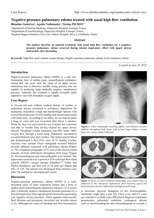 Negative-pressure pulmonary edema treated with nasal high flow ventilation