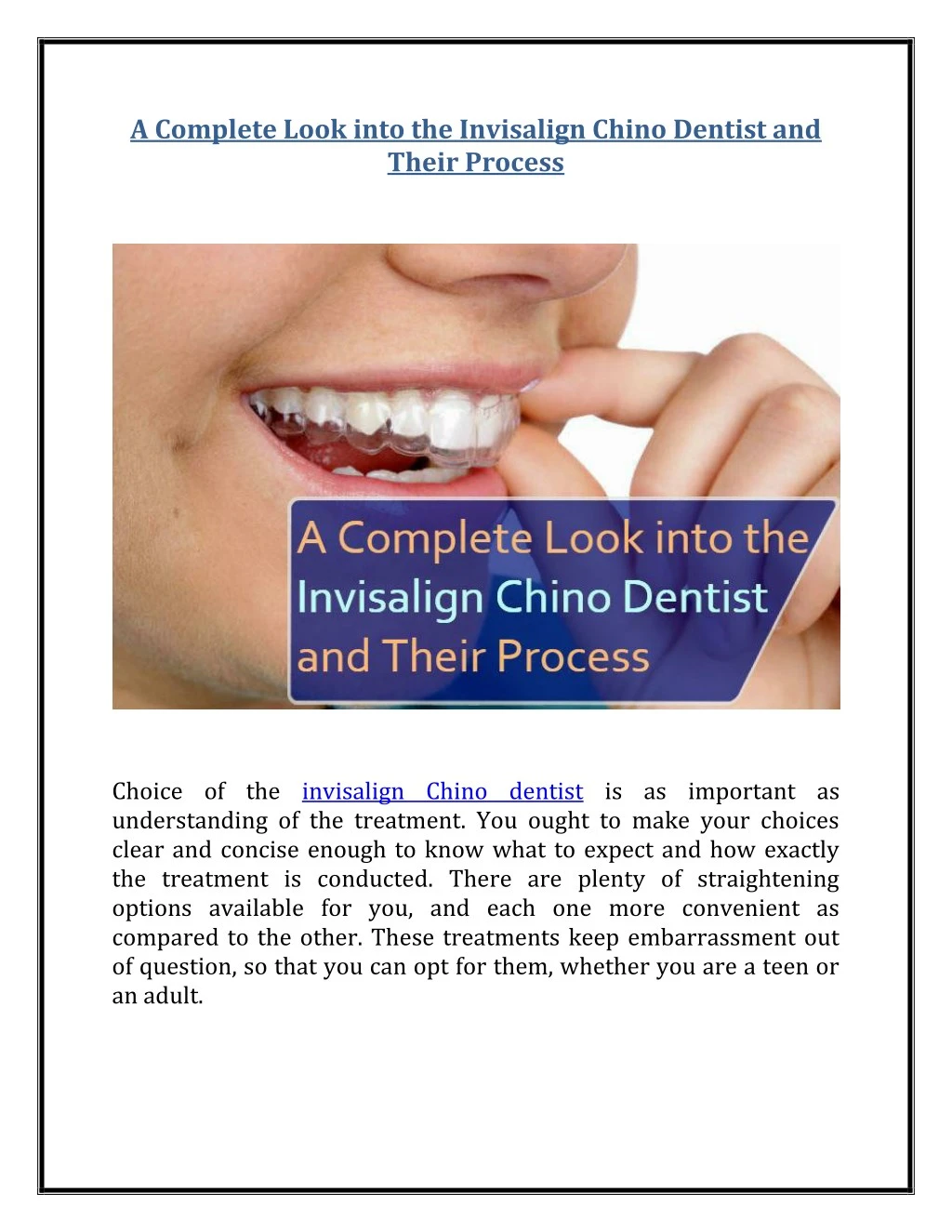 a complete look into the invisalign chino dentist