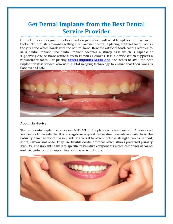 Get Dental Implants from the Best Dental Service Provider