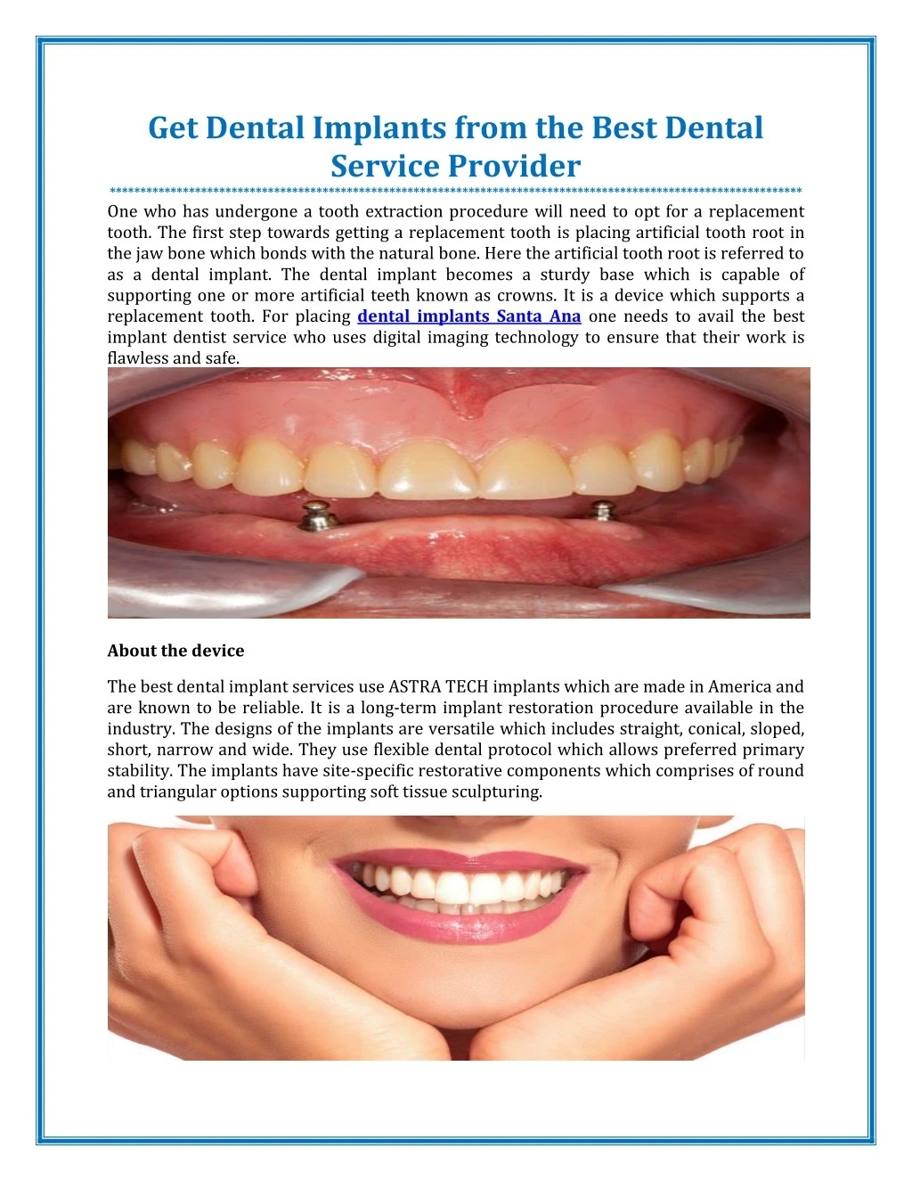 get dental implants from the best dental service