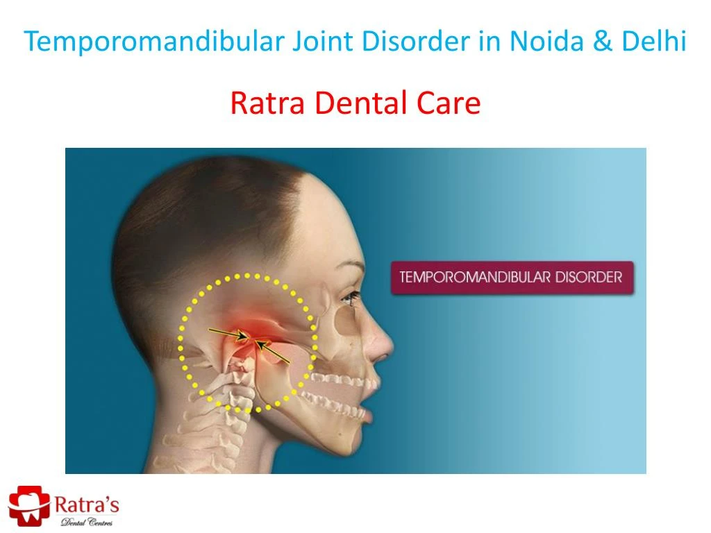 temporomandibular joint disorder in noida delhi
