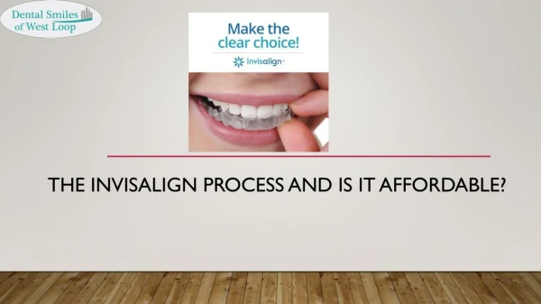The Invisalign Process And Is It Affordable?