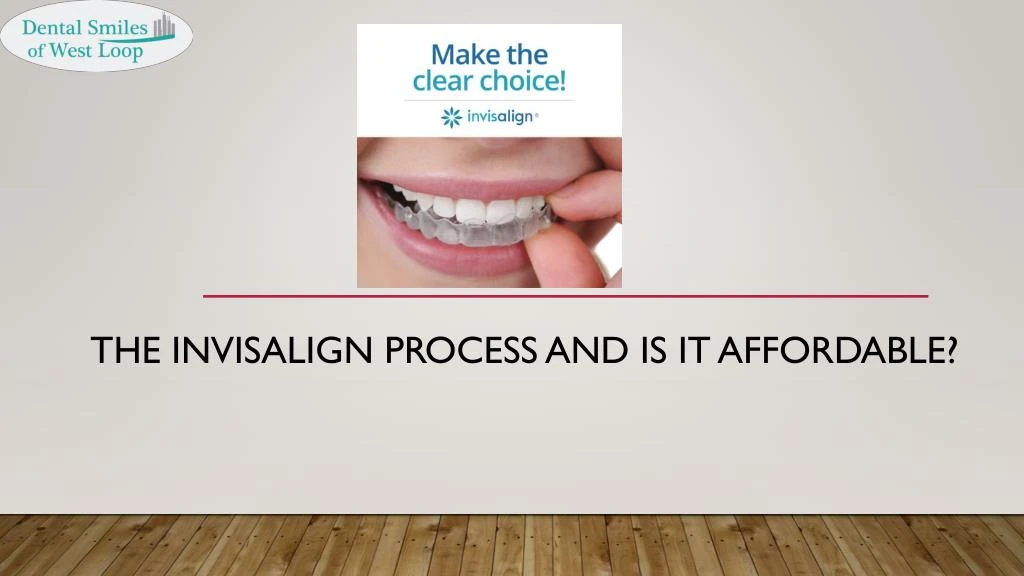 the invisalign process and is it affordable