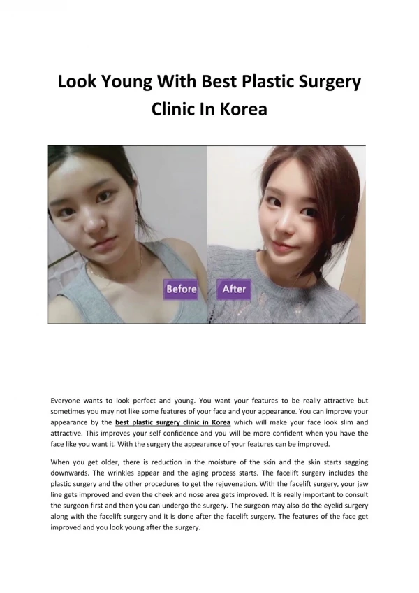 Look Young With Best Plastic Surgery Clinic In Korea