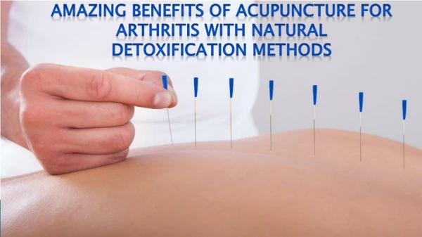 Amazing Benefits of Acupuncture for Arthritis with Natural Detoxification Methods