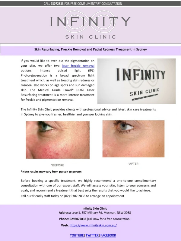 Skin Resurfacing, Freckle Removal and Facial Redness Treatment in Sydney