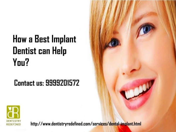 How a best Implant Dentist can help you?