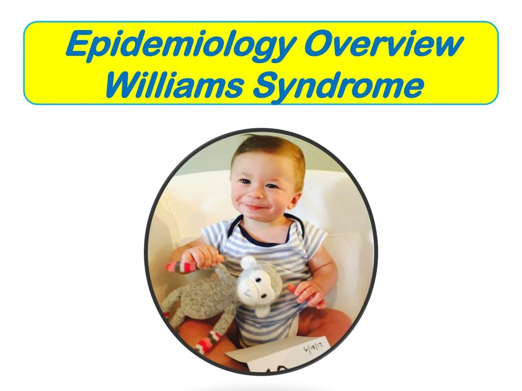 epidemiology overview williams syndrome