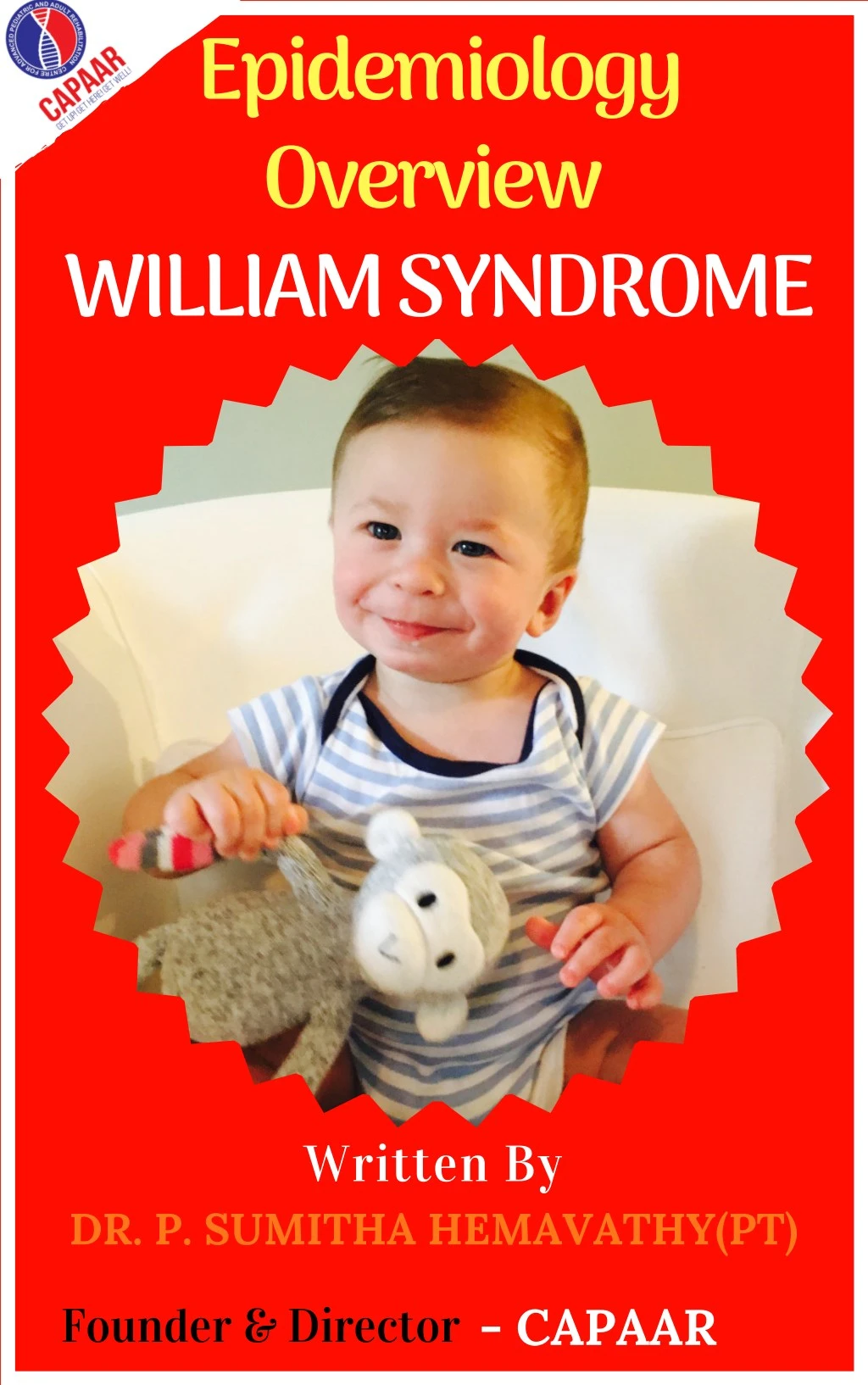 epidemiology overview william syndrome