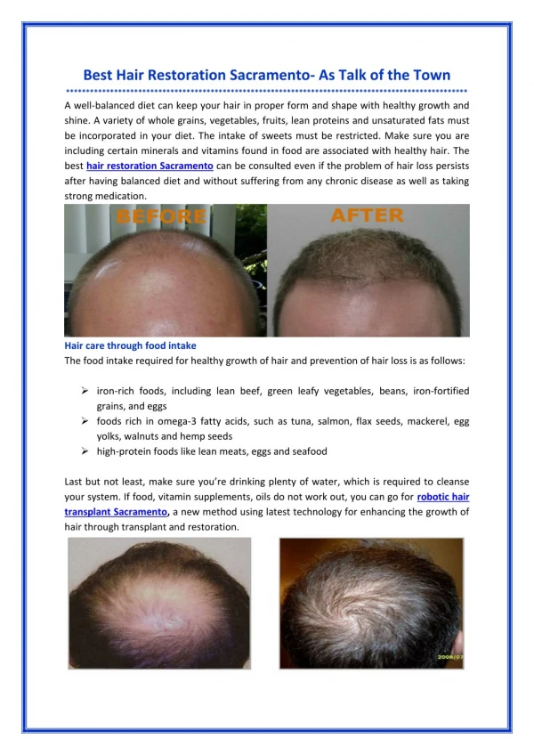 Best Hair Restoration Sacramento- As Talk of the Town