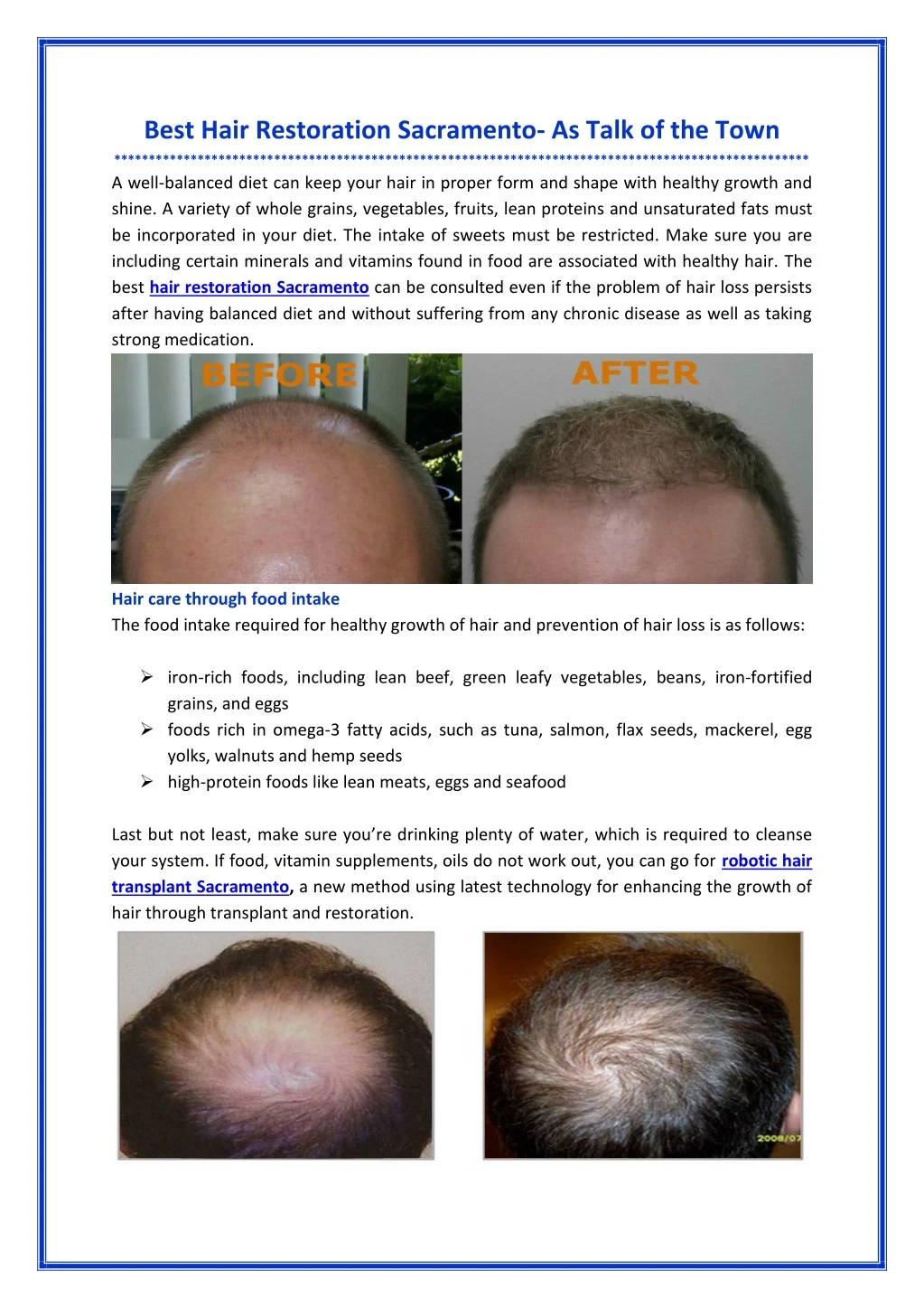 best hair restoration sacramento as talk