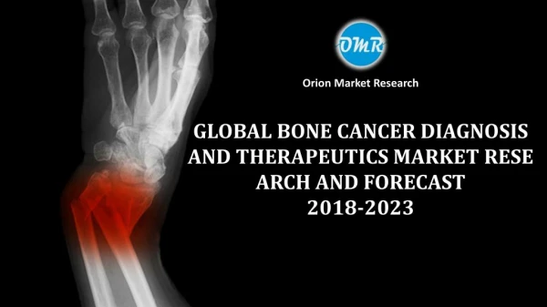 Global Bone Cancer Diagnosis and Therapeutics Market Research and Forecast 2018-2023
