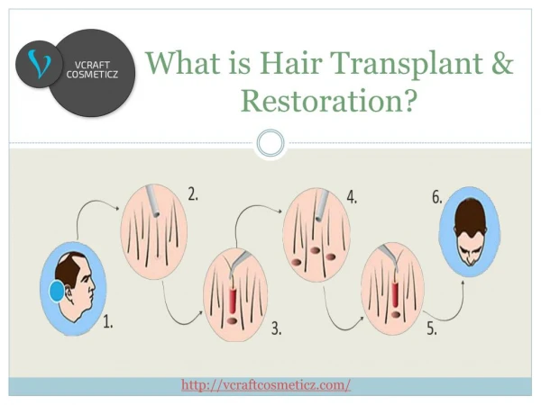 What is hair transplant & restoration