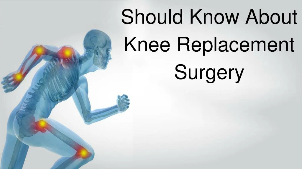 should know about knee replacement surgery