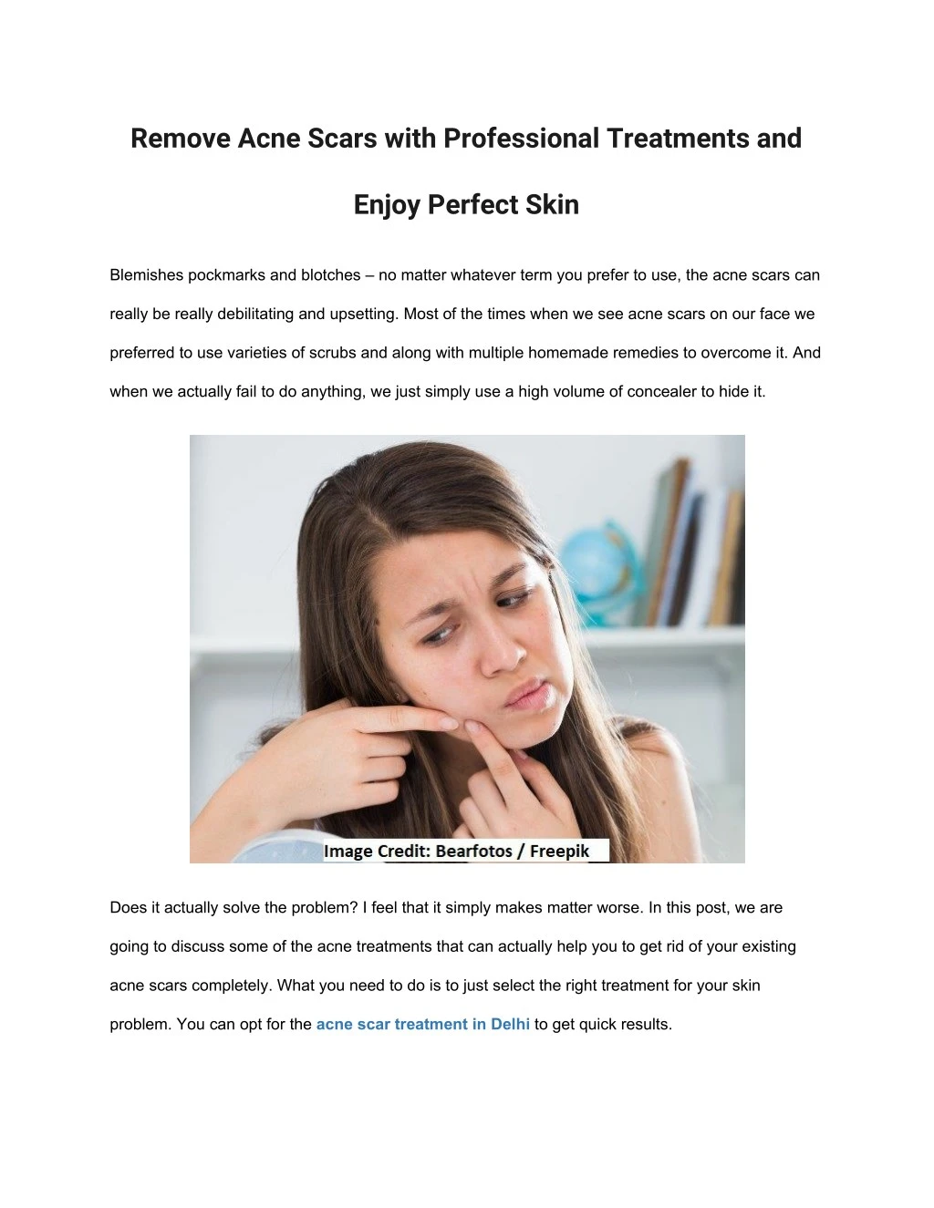 remove acne scars with professional treatments and