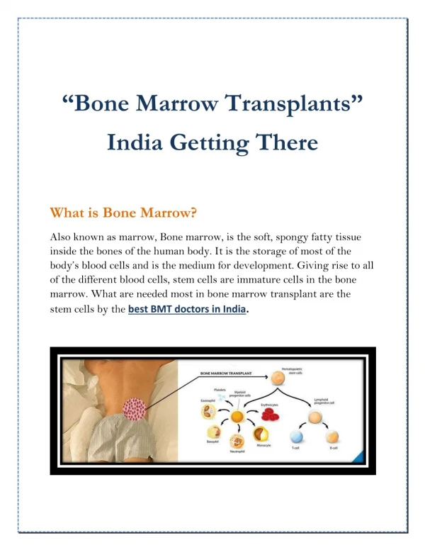 Bone Marrow Transplants - India getting there