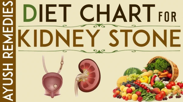 Kidney Stone Diet, List of Foods to Eat and Avoid During Kidney Stones