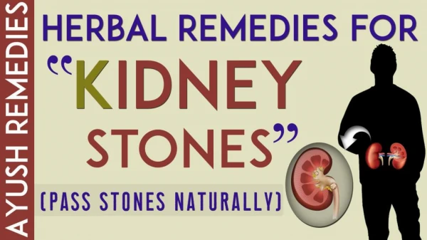 Best Ayurvedic Treatment for Passing a Kidney Stone and Symptoms