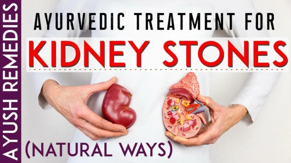 Best Way to Pass a Kidney Stone without Surgery Naturally at Home