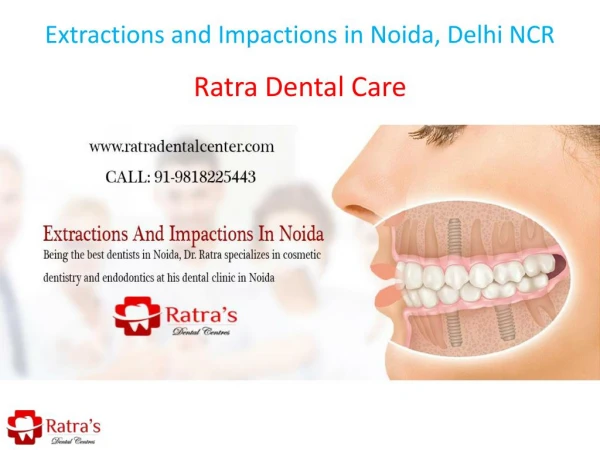 Extractions and Impactions in Noida, Delhi NCR