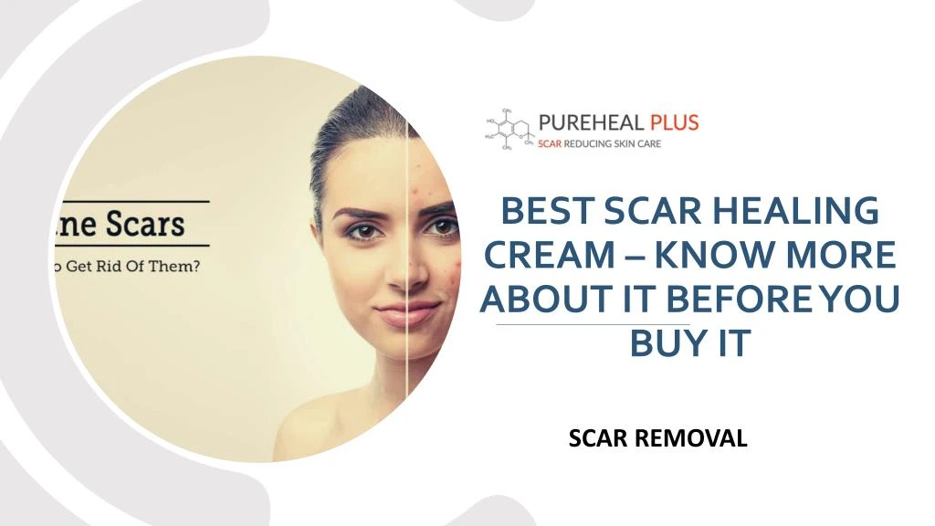 best scar healing cream know more about it before you buy it