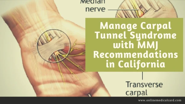 Manage Carpal Tunnel Syndrome with MMJ Recommendations in California