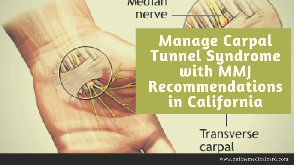 manage carpal tunnel syndrome with
