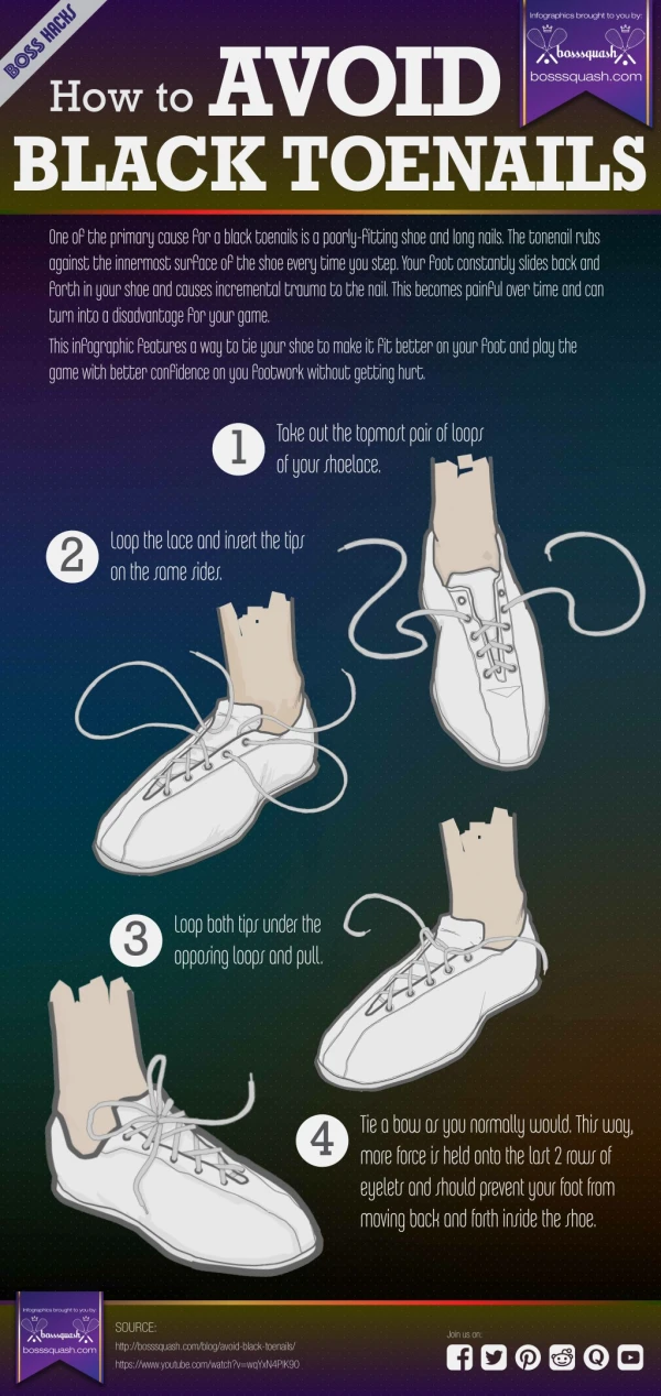 How To Avoid Black Toenails-A Complete Infographic