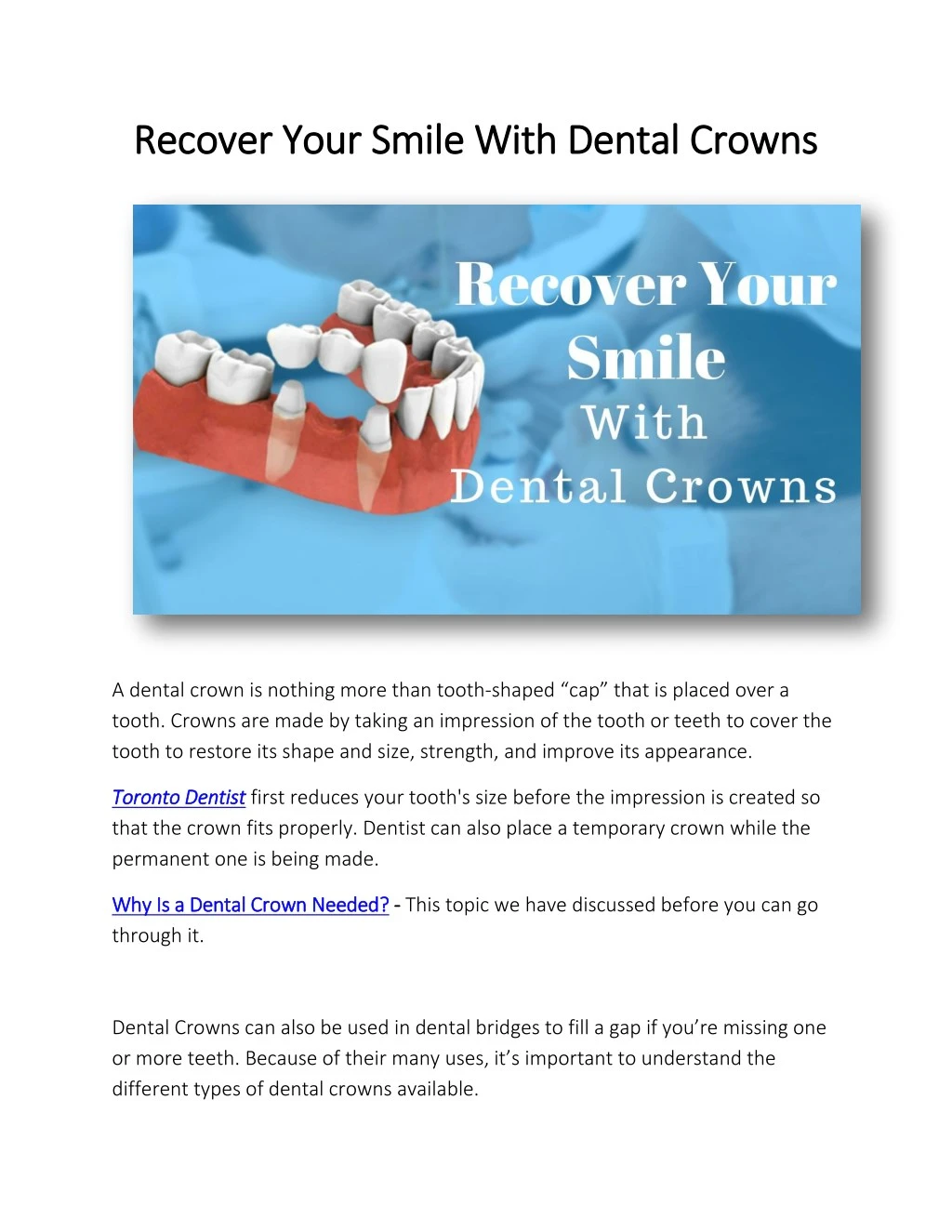 recover your smile with dental crowns recover
