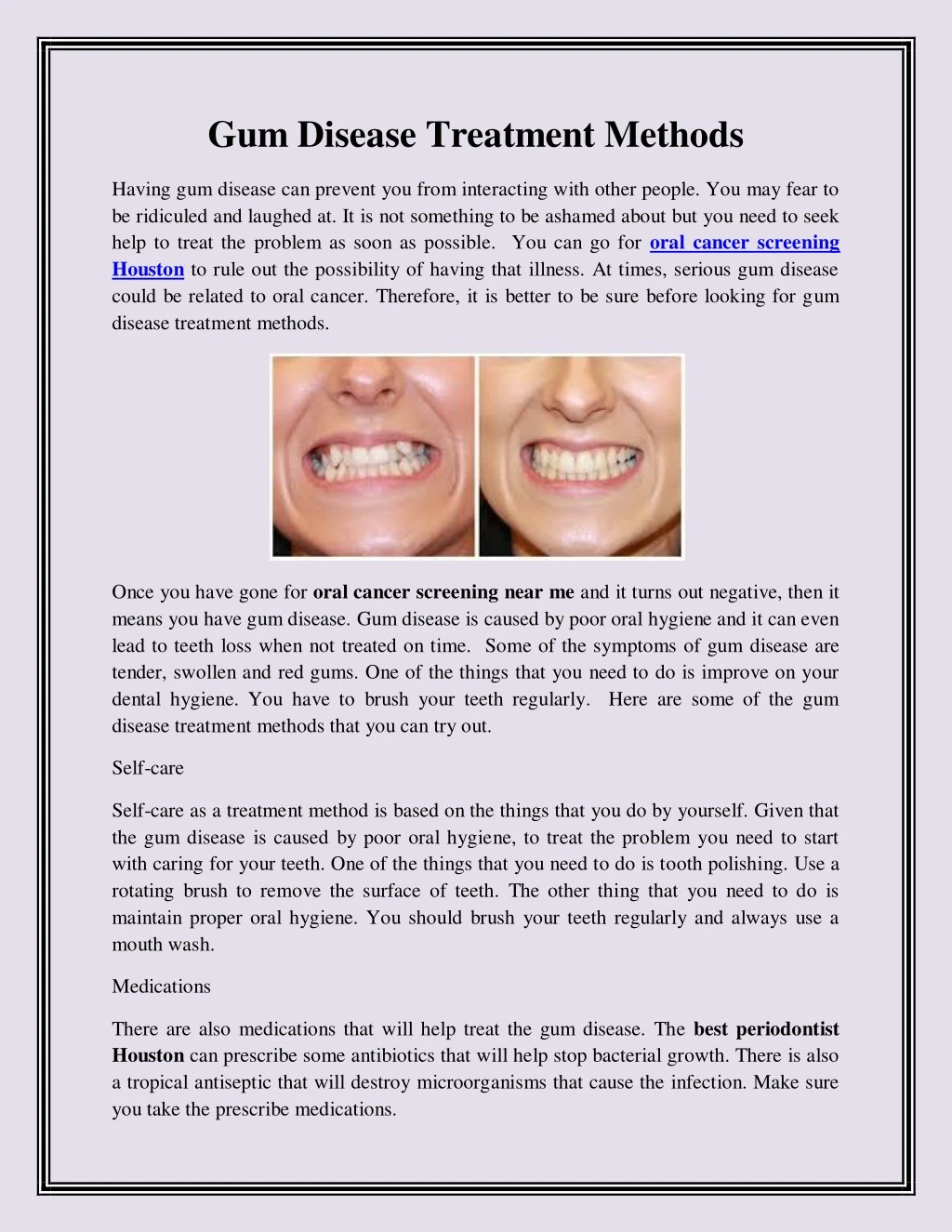 gum disease treatment methods