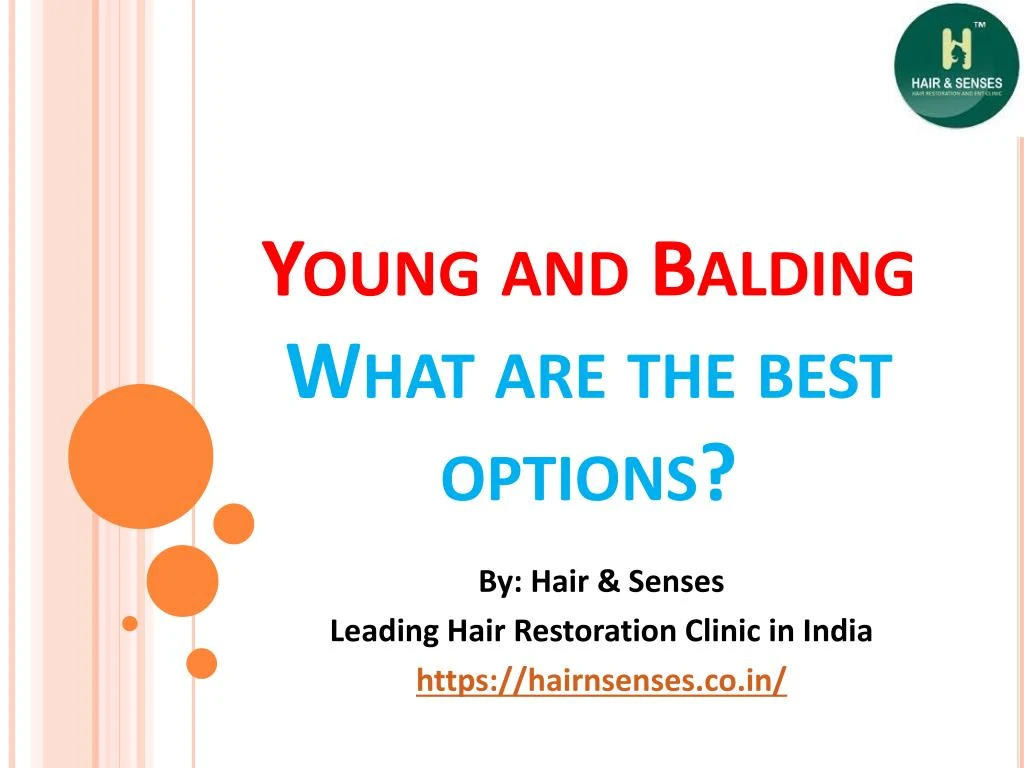 young and balding what are the best options