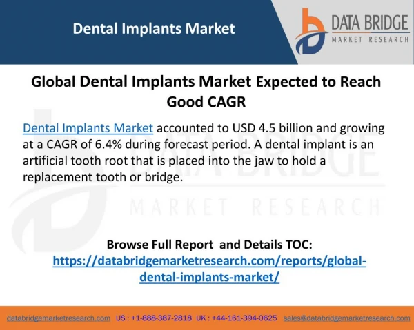 Dental Implants Market 2018: Industry Analysis, Competitors Size & Share, Trends, Demand, Global Research to 2025