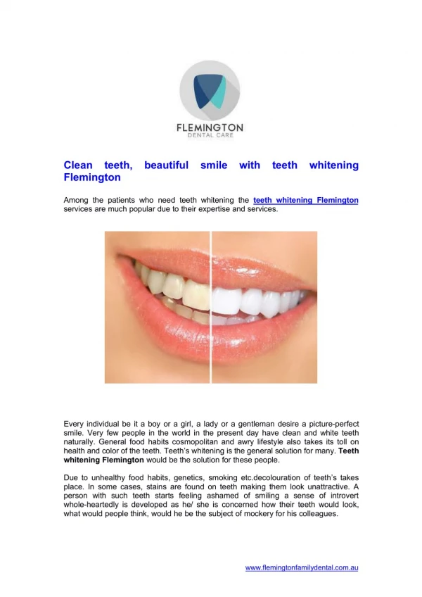 Clean teeth beautiful smile with teeth whitening Flemington