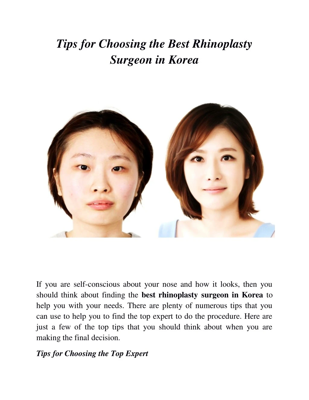 tips for choosing the best rhinoplasty surgeon
